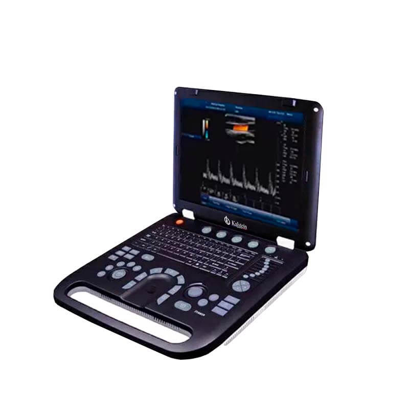 Analyse du retour sur investissement des systèmes de diagnostic Doppler couleur ultrasons