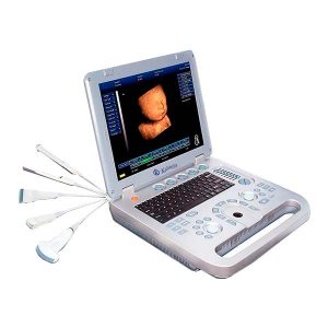Comment utiliser un scanner à ultrasons ?