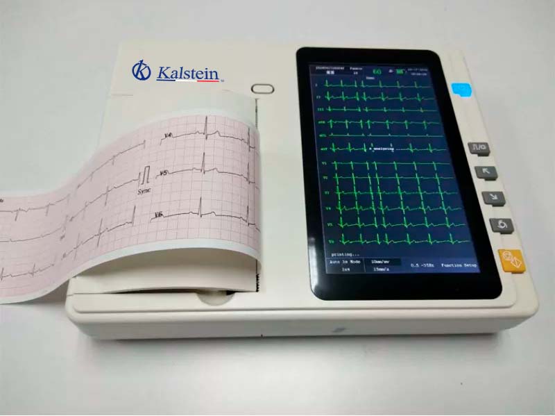 Utilisation de l'électrocardiographe pour le diagnostic de la myocardite aiguë