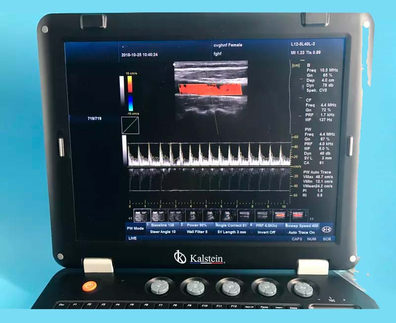 Machine médicale d'ultrason THI 3D article 128 à vendre avec sonde convexe YR05148 – 1