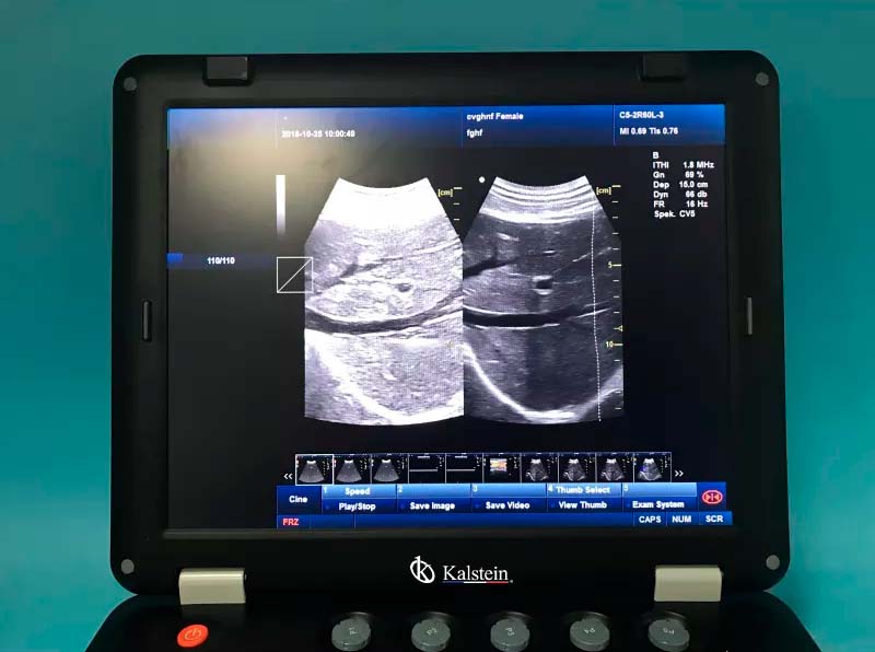 Machine médicale d'ultrason THI 3D article 128 à vendre avec sonde convexe YR05148 – 2