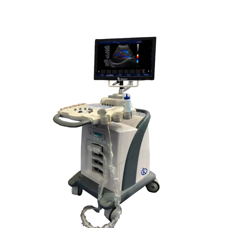 La Révolution Silencieuse : Système de Diagnostic Doppler Couleur à Ultrasons