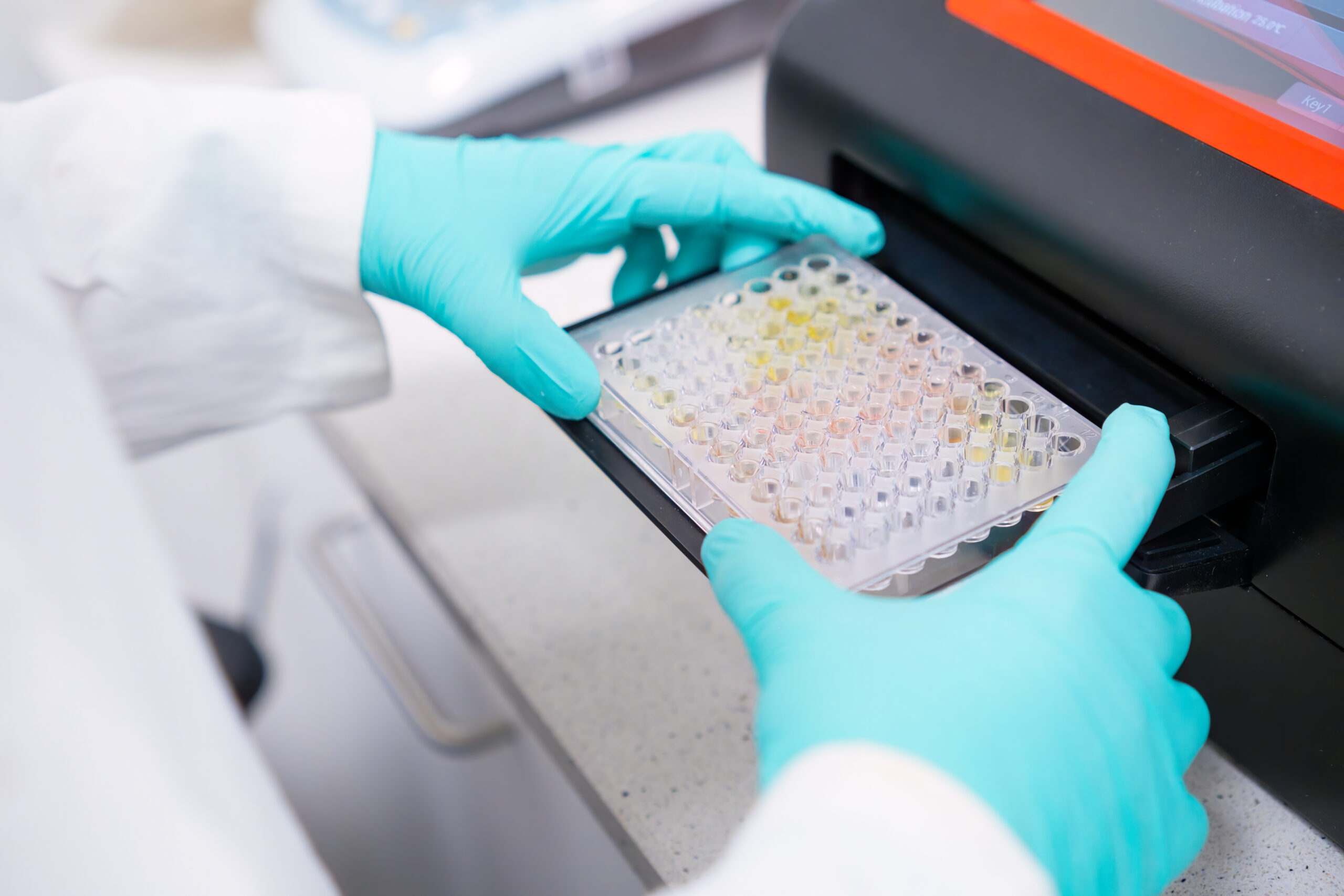 Amélioration des performances des lecteurs de microplaques ELISA en laboratoire grace à des applications scientifiques avancées
