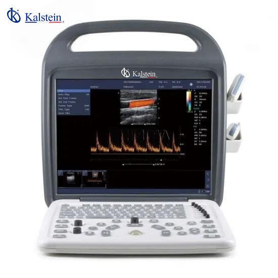 Comparaison des Systèmes Doppler Couleur Vétérinaire YR06140 et SonoVet R3